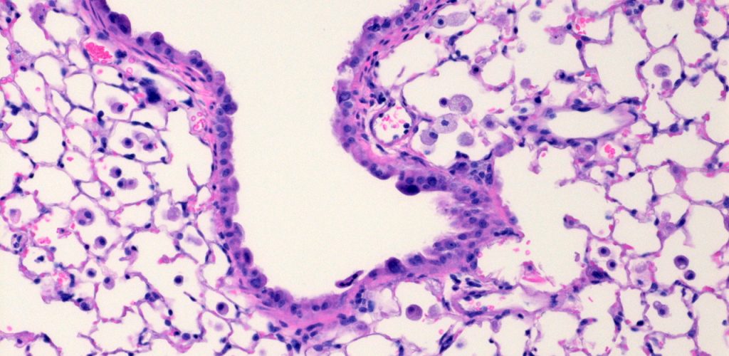 Lung histology